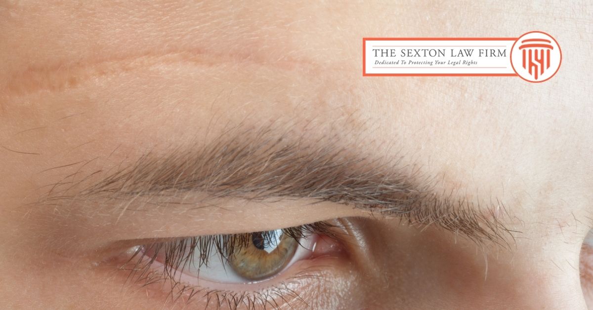 Are Dog Bite Scars Permanent?